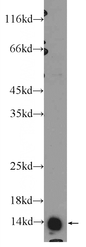 PC-3 cells were subjected to SDS PAGE followed by western blot with Catalog No:110801(GABARAPL2 Antibody) at dilution of 1:600