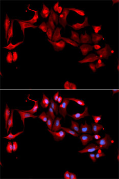 Immunofluorescence - GP9 Polyclonal Antibody 