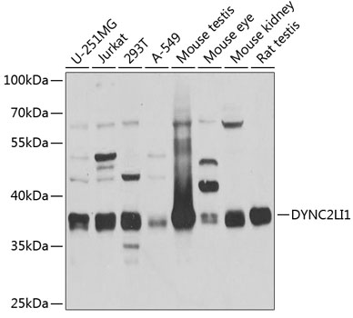 Western blot - DYNC2LI1 Polyclonal Antibody 