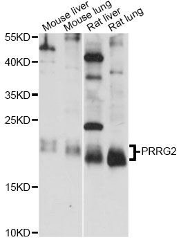 Western blot - PRRG2 Polyclonal Antibody 