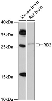 Western blot - RD3 Polyclonal Antibody 
