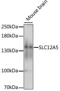 Western blot - SLC12A5 Polyclonal Antibody 