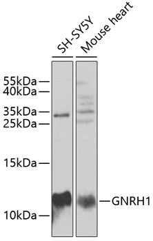 Western blot - GNRH1 Polyclonal Antibody 