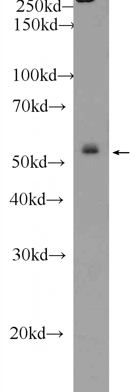 HepG2 cells were subjected to SDS PAGE followed by western blot with Catalog No:116966(ZNF253 Antibody) at dilution of 1:300