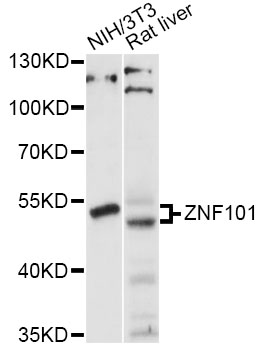 Western blot - ZNF101 Polyclonal Antibody 