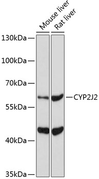 Western blot - CYP2J2 Polyclonal Antibody 