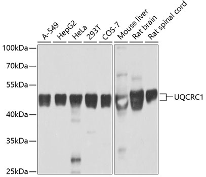 Western blot - UQCRC1 Polyclonal Antibody 