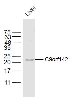 Fig1: Sample:; Liver (Mouse) Lysate at 40 ug; Primary: Anti-C9orf142 at 1/300 dilution; Secondary: IRDye800CW Goat Anti-Rabbit IgG at 1/20000 dilution; Predicted band size: 22 kD; Observed band size: 22 kD