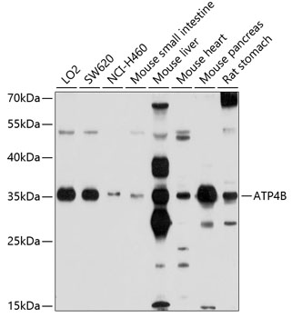 Western blot - ATP4B Polyclonal Antibody 