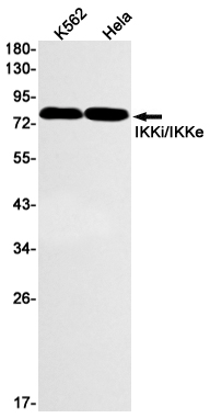 Western blot detection of Phospho-Src (Tyr419) in K562,Hela cell lysates using Phospho-Src (Tyr419) Rabbit mAb(1:1000 diluted).Predicted band size:60kDa.Observed band size:60kDa.