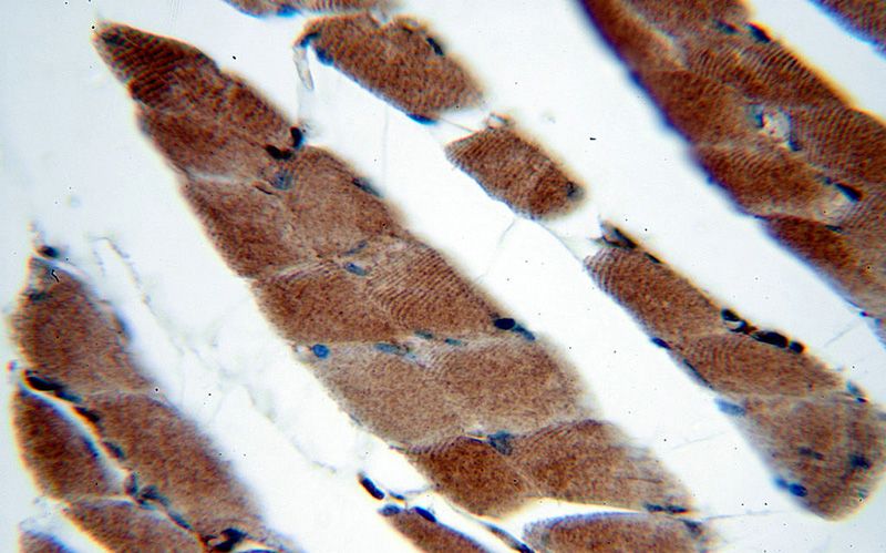 Immunohistochemical of paraffin-embedded human skeletal muscle using Catalog No:115204(SERPINB6 antibody) at dilution of 1:50 (under 40x lens)
