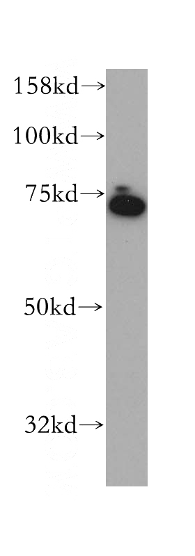 Y79 cells were subjected to SDS PAGE followed by western blot with Catalog No:111979(KCNS2 antibody) at dilution of 1:300