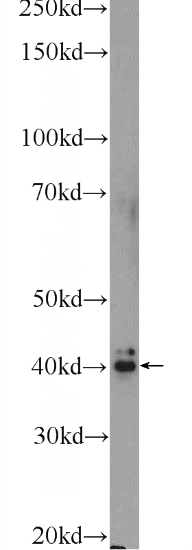 human plasma tissue were subjected to SDS PAGE followed by western blot with Catalog No:110720(FREM1 Antibody) at dilution of 1:300