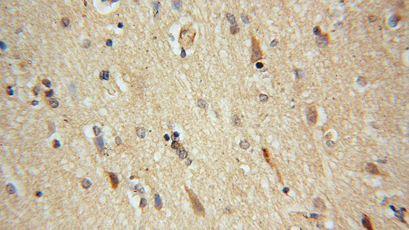 Immunohistochemical of paraffin-embedded human brain using Catalog No:115717(STK32A antibody) at dilution of 1:50 (under 40x lens)