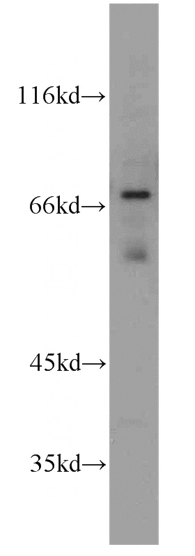 human brain tissue were subjected to SDS PAGE followed by western blot with Catalog No:116491(TULP1 antibody) at dilution of 1:500
