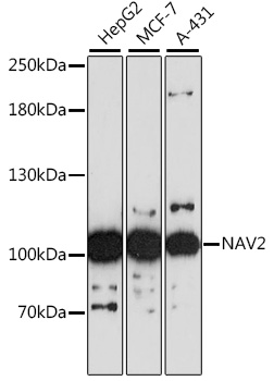 Western blot - NAV2 Polyclonal Antibody 