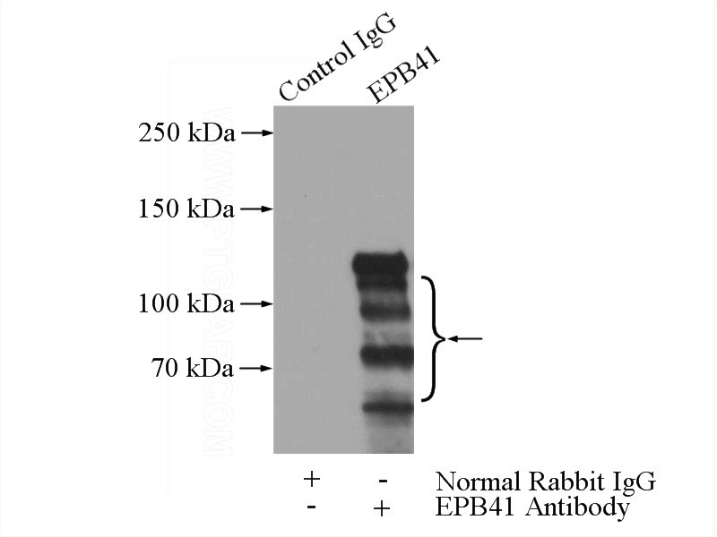 IP Result of anti-EPB41 (IP:Catalog No:110343, 4ug; Detection:Catalog No:110343 1:200) with HL-60 cells lysate 4000ug.