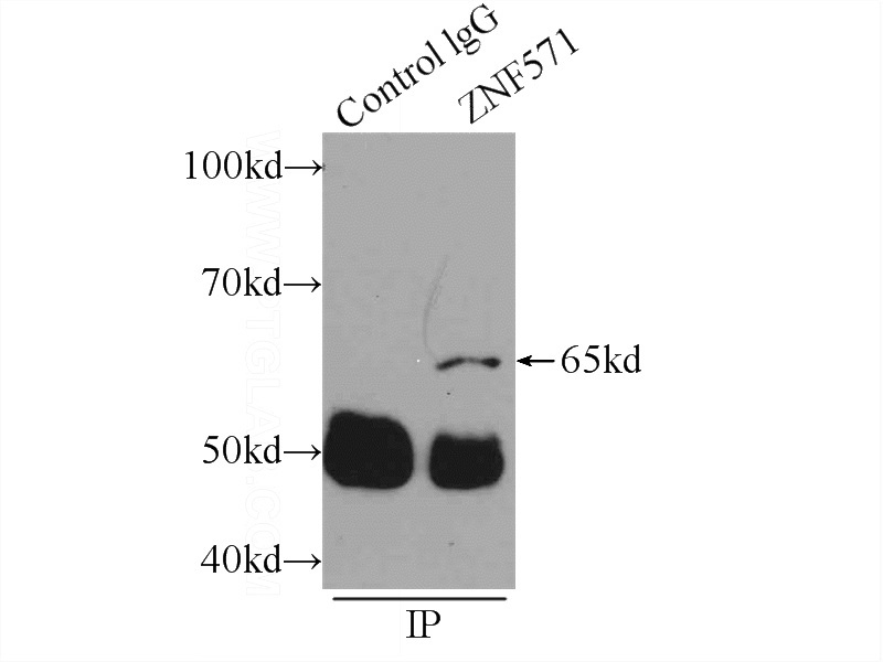IP Result of anti-ZNF571 (IP:Catalog No:117005, 4ug; Detection:Catalog No:117005 1:300) with MCF-7 cells lysate 1200ug.