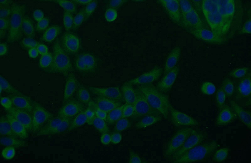 Immunofluorescent analysis of HeLa cells using Catalog No:113157(NFKB2 Antibody) at dilution of 1:25 and Alexa Fluor 488-congugated AffiniPure Goat Anti-Rabbit IgG(H+L)