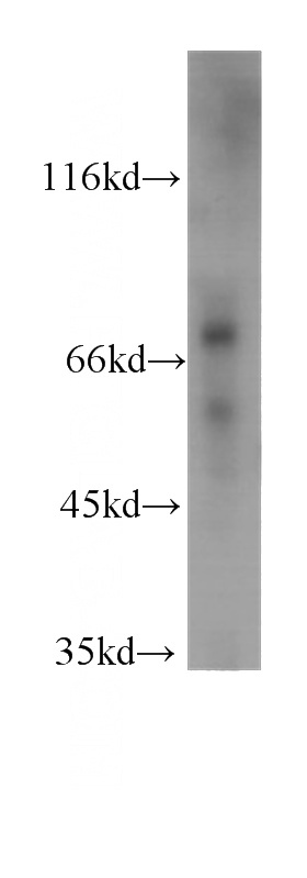 A431 cells were subjected to SDS PAGE followed by western blot with Catalog No:107475(PLAA antibody) at dilution of 1:1000