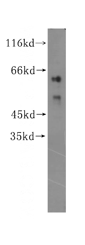 HeLa cells were subjected to SDS PAGE followed by western blot with Catalog No:117165(ZNF35 antibody) at dilution of 1:300