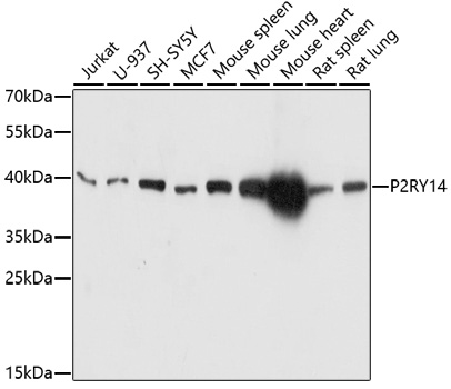 Western blot - P2RY14 Polyclonal Antibody 