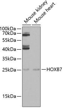 Western blot - HOXB7 Polyclonal Antibody 