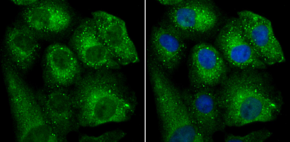 Fig2: ICC staining BHLHB9 in A549 cells (green). The nuclear counter stain is DAPI (blue). Cells were fixed in paraformaldehyde, permeabilised with 0.25% Triton X100/PBS.