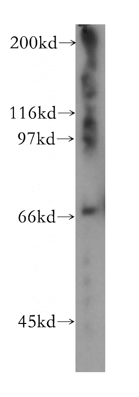 human heart tissue were subjected to SDS PAGE followed by western blot with Catalog No:112007(KIF22 antibody) at dilution of 1:400