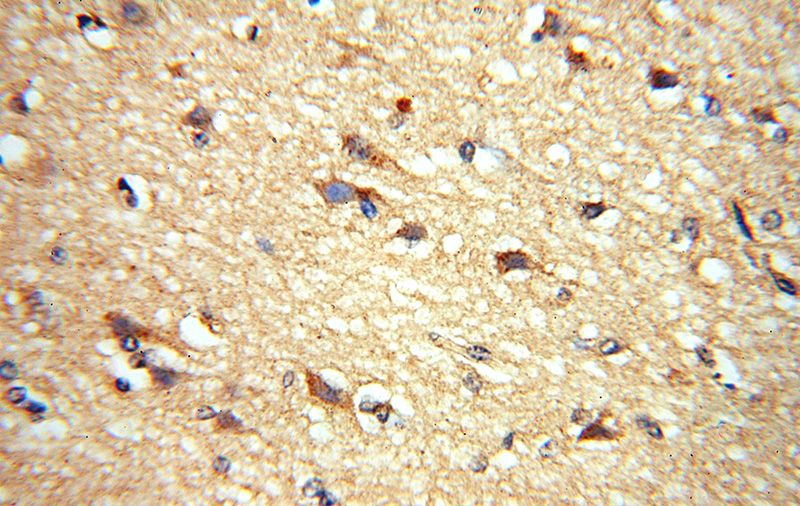Immunohistochemical of paraffin-embedded human brain using Catalog No:107797(ADO antibody) at dilution of 1:50 (under 40x lens)