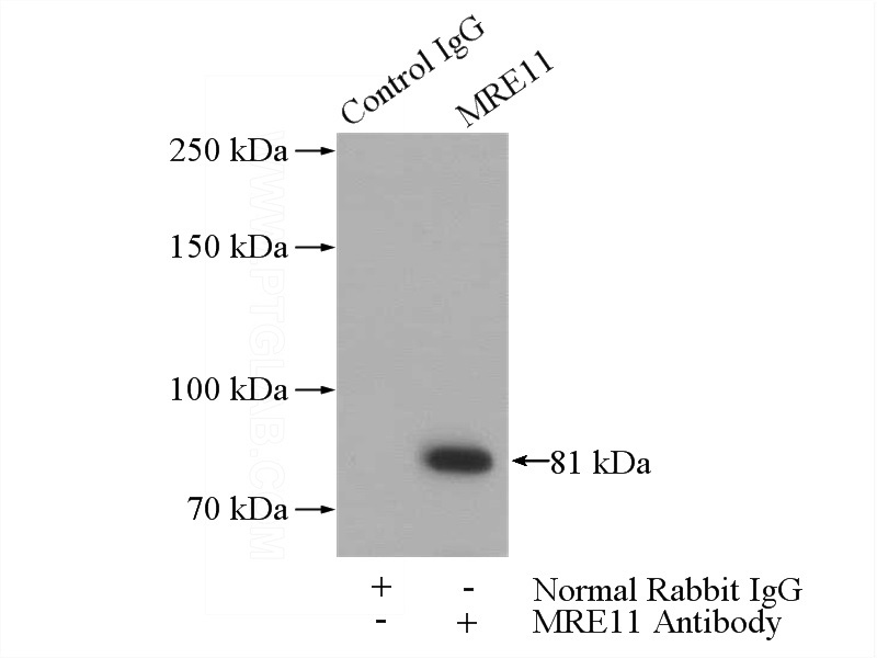 IP Result of anti-MRE11A (IP:Catalog No:112802, 4ug; Detection:Catalog No:112802 1:600) with HeLa cells lysate 1200ug.