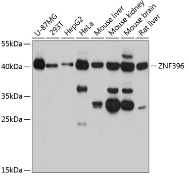 Western blot - ZNF396 Polyclonal Antibody 