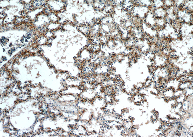 Immunohistochemical of paraffin-embedded human lung using Catalog No:115349(SLC7A5 antibody) at dilution of 1:50 (under 10x lens)