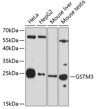 Western blot - GSTM3 Polyclonal Antibody 