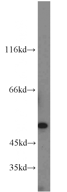 Jurkat cells were subjected to SDS PAGE followed by western blot with Catalog No:108664(C14orf39 antibody) at dilution of 1:1000