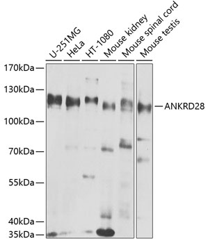 Western blot - ANKRD28 Polyclonal Antibody 