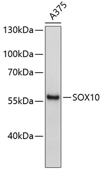 Western blot - SOX10 Polyclonal Antibody 