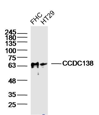 Fig1: Sample:; FHC(human) Cell Lysate at 40 ug; HT29(human) Cell Lysate at 40 ug; Primary: Anti-CCDC138 at 1/300 dilution; Secondary: IRDye800CW Goat Anti-Rabbit IgG at 1/20000 dilution; Predicted band size: 76/66kD; Observed band size: 66kD