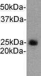 Fig1:; Western blot analysis of Ly-6G on mouse liver tissue lysates. Proteins were transferred to a PVDF membrane and blocked with 5% BSA in PBS for 1 hour at room temperature. The primary antibody ( 1/500) was used in 5% BSA at room temperature for 2 hours. Goat Anti-Rabbit IgG - HRP Secondary Antibody (HA1001) at 1:5,000 dilution was used for 1 hour at room temperature.