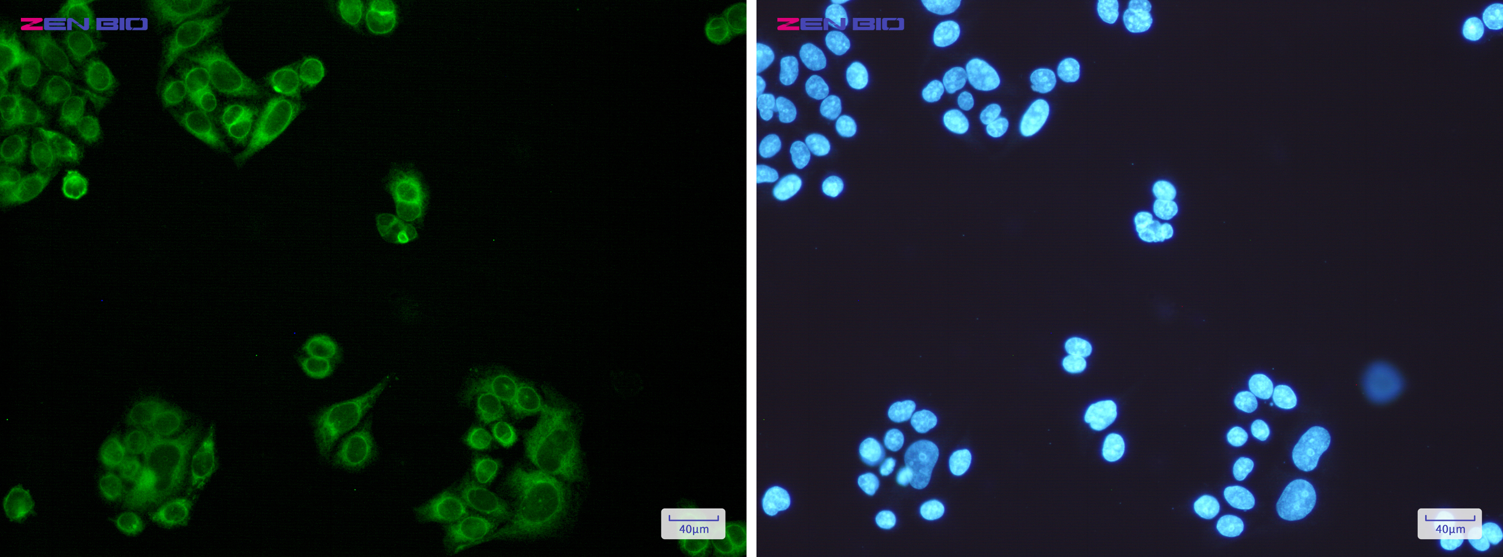 Immunocytochemistry of ELOVL5(green) in Hela cells using ELOVL5 Rabbit mAb at dilution 1/200, and DAPI(blue)