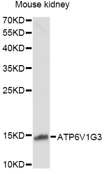 Western blot - ATP6V1G3 Polyclonal Antibody 