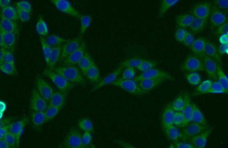 Immunofluorescent analysis of HepG2 cells using Catalog No:117205(UBL7 Antibody) at dilution of 1:25 and Alexa Fluor 488-congugated AffiniPure Goat Anti-Rabbit IgG(H+L)