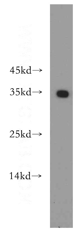 HeLa cells were subjected to SDS PAGE followed by western blot with Catalog No:110414(EXOSC8 antibody) at dilution of 1:500