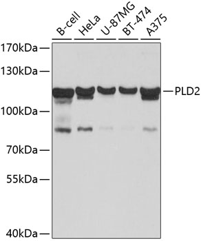 Western blot - PLD2 Polyclonal Antibody 