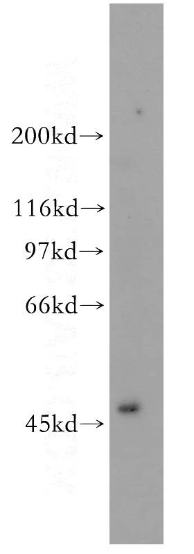 MCF7 cells were subjected to SDS PAGE followed by western blot with Catalog No:115998(TFAP2A,AP-2 antibody) at dilution of 1:300