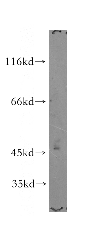 HepG2 cells were subjected to SDS PAGE followed by western blot with Catalog No:113876(PI4K2A antibody) at dilution of 1:800