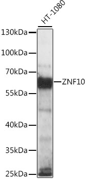 Western blot - ZNF10 Polyclonal Antibody 