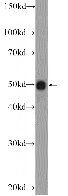 MDA-MB-453s cells were subjected to SDS PAGE followed by western blot with Catalog No:114362(PYGO2 Antibody) at dilution of 1:600