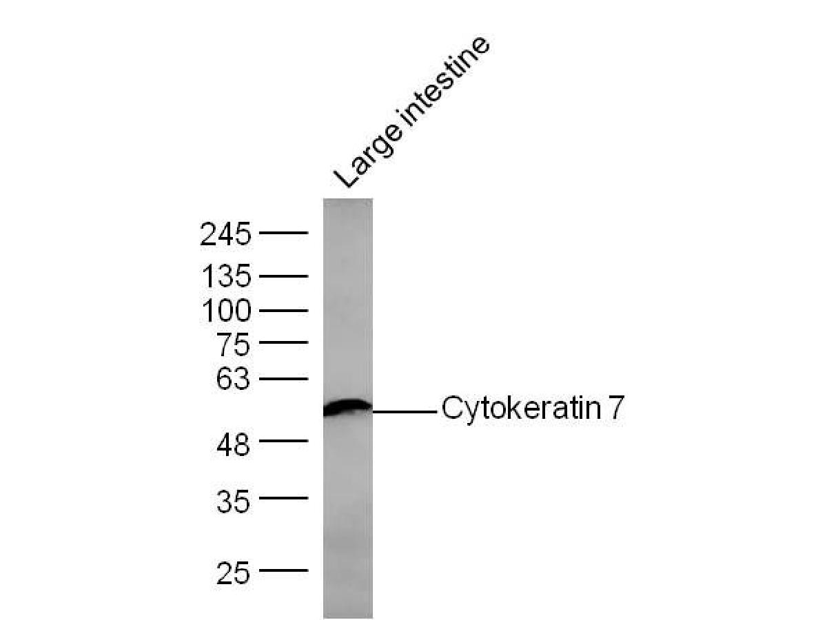 Fig3: Sample: Large intestine (Mouse) Lysate at 30 ug; Primary: Anti- Cytokeratin 7 at 1/300 dilution; Secondary: IRDye800CW Goat Anti-Mouse IgG at 1/10000 dilution; Predicted band size: 54 kD; Observed band size: 54 kD