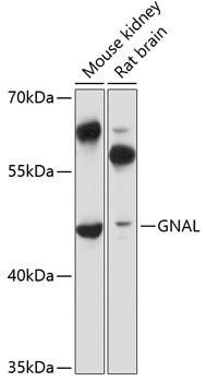 Western blot - GNAL Polyclonal Antibody 
